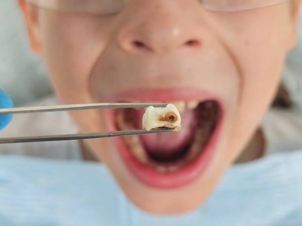 Best Emergency Dentist for Kids  in Reno, OH